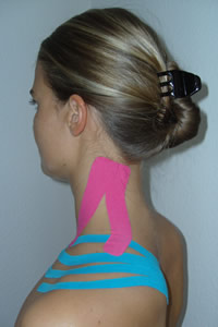 Kinesio Taping